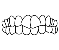 Crowded teeth