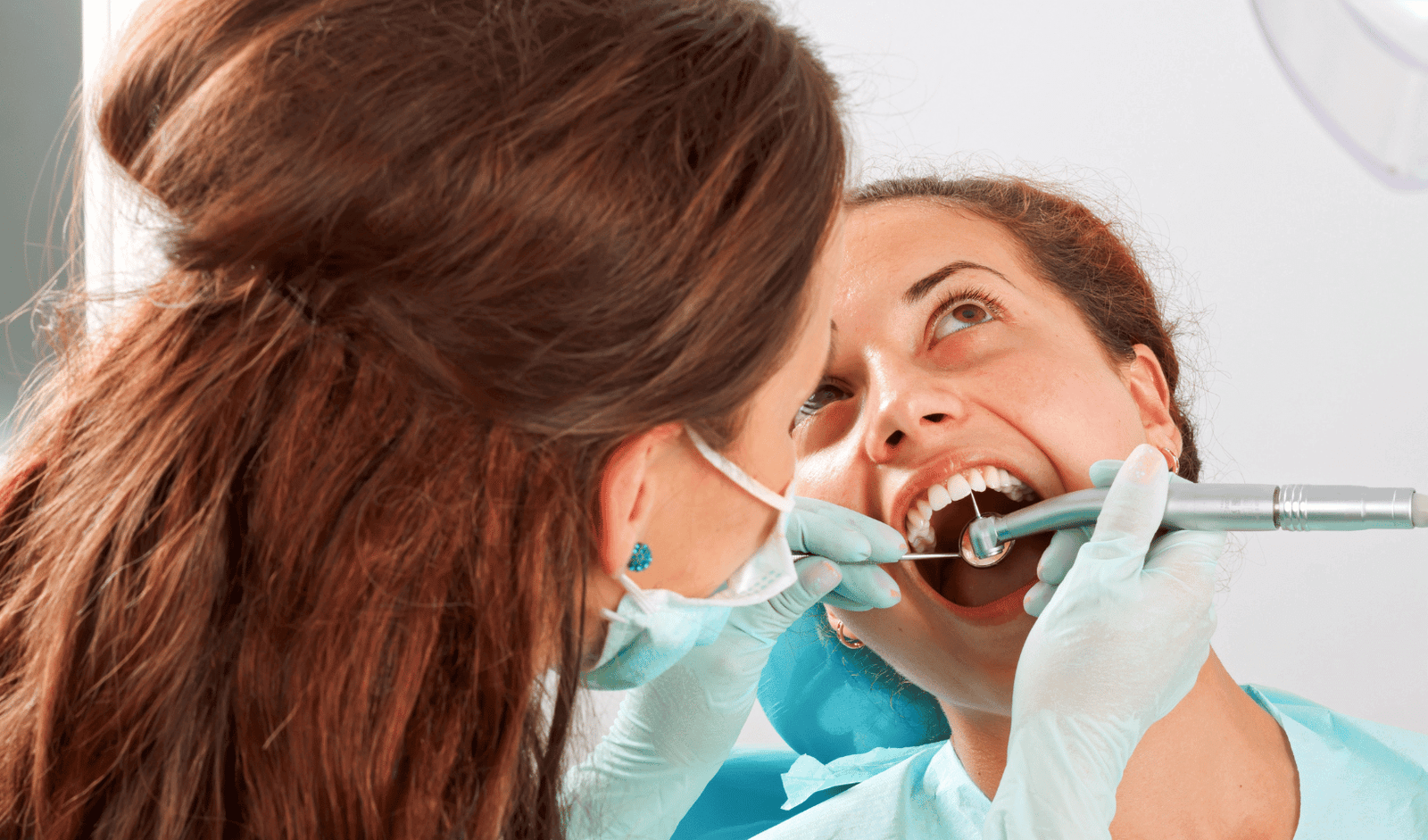 Dental Filling Service in Hyderabad