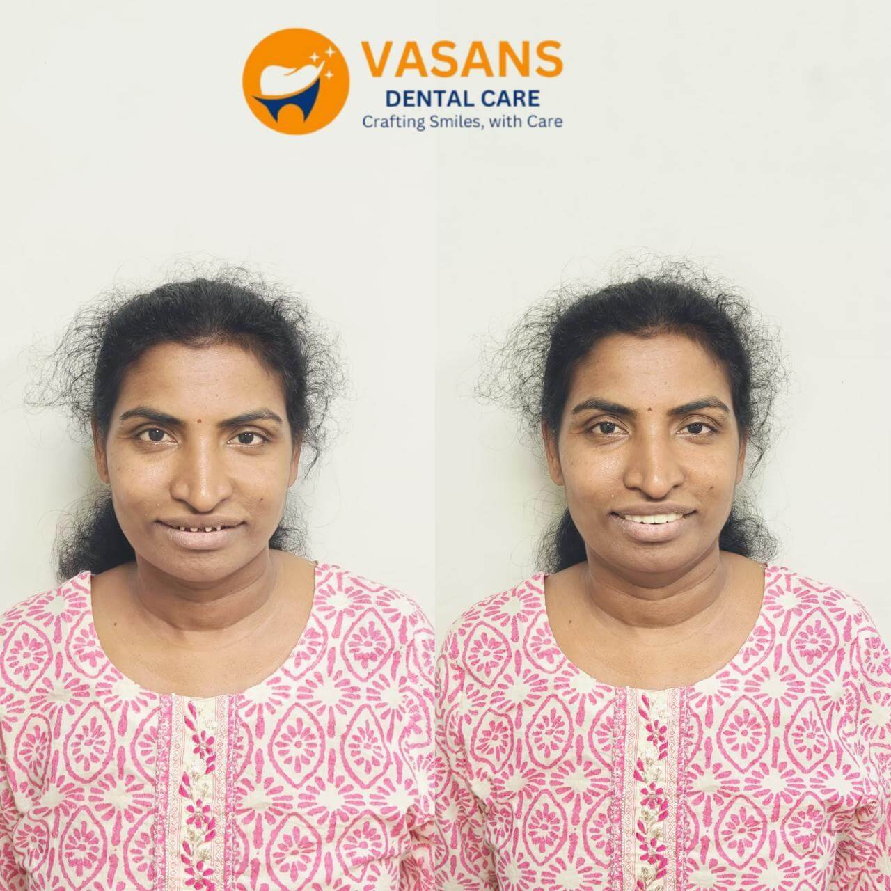 Best Dental Clinic in Hyderabad