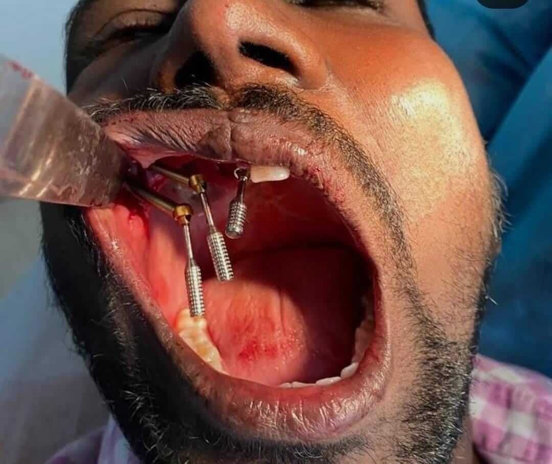 vasan-dental-care-gallery (10)
