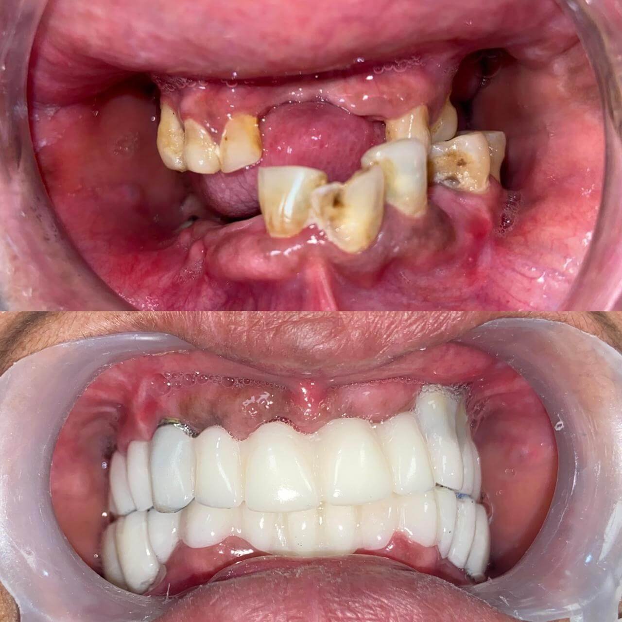 vasan-dental-care-gallery (11)