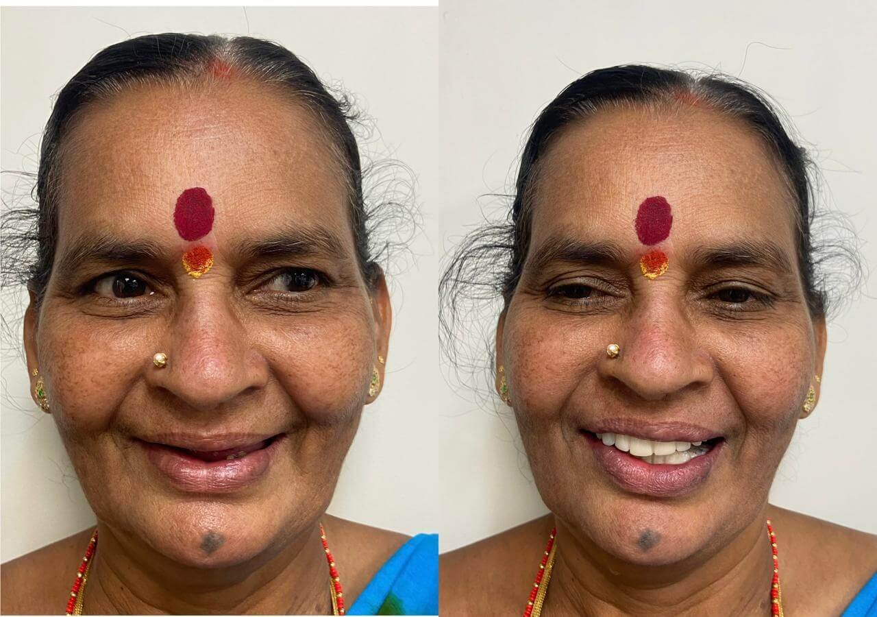 vasan-dental-care-gallery (12)