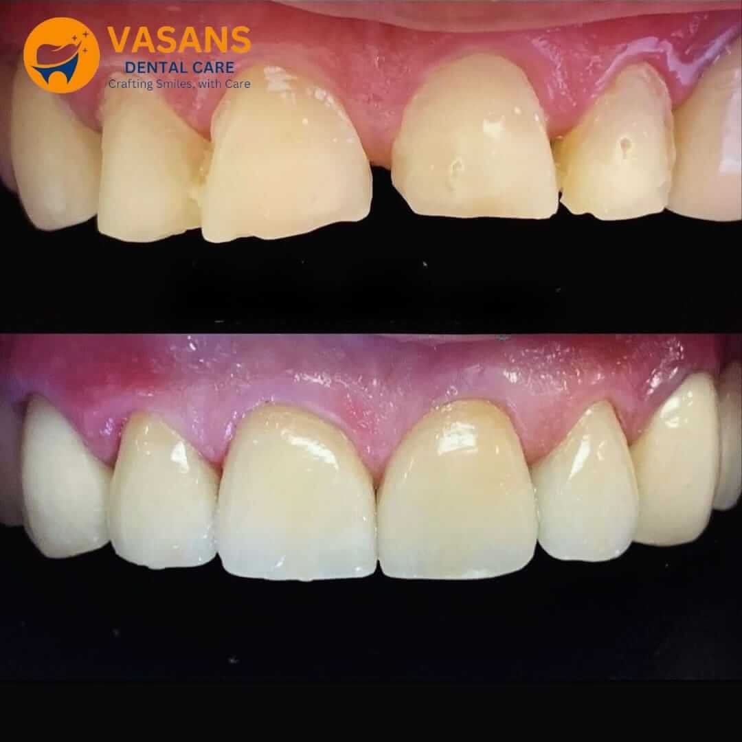 vasan-dental-care-gallery (2)