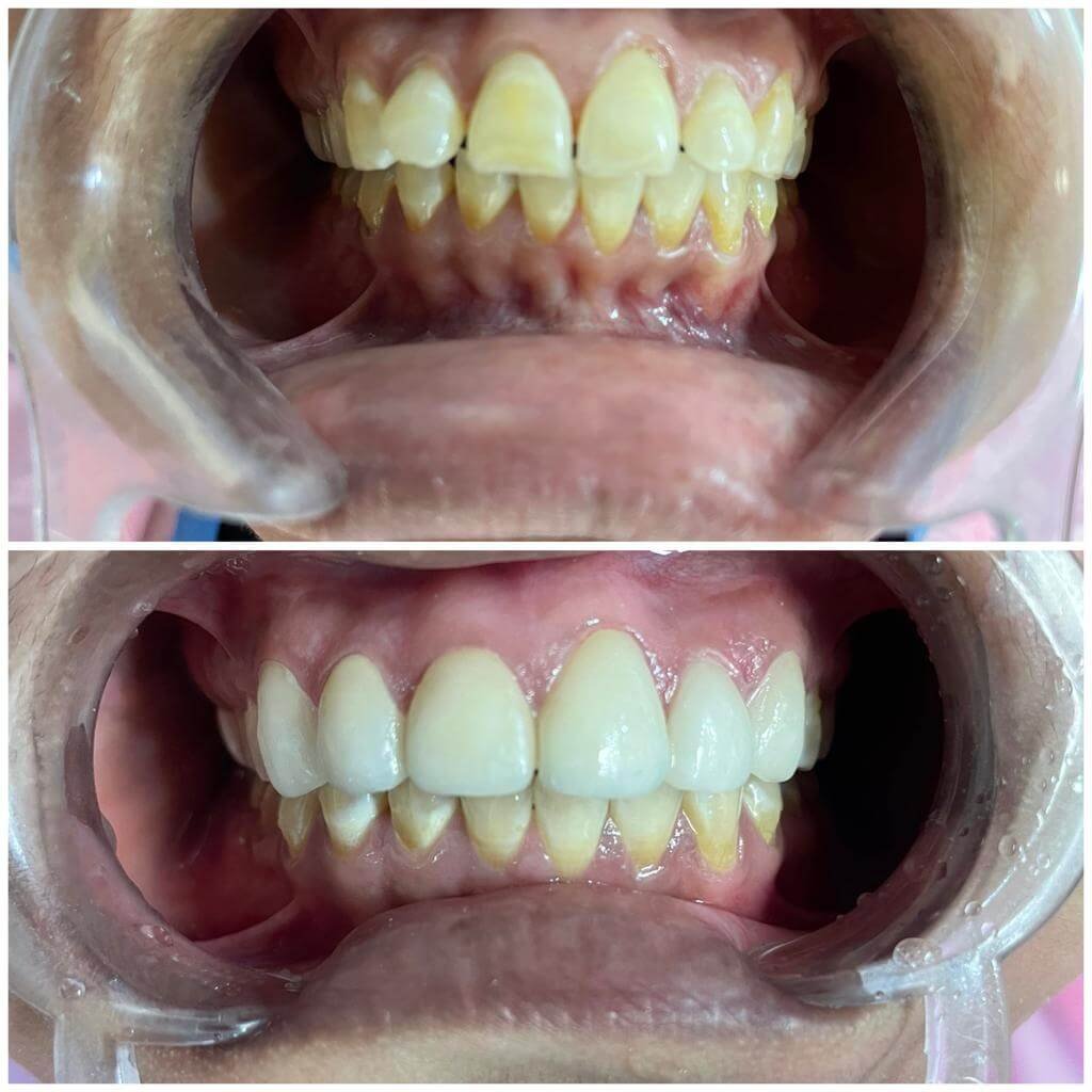 vasan-dental-care-gallery (3)