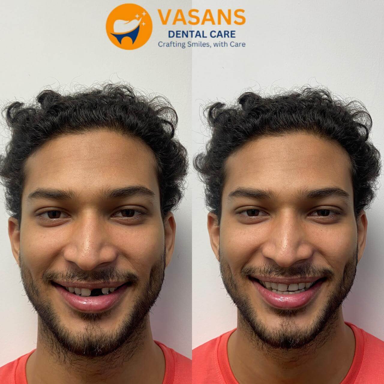 vasan-dental-care-gallery (5)