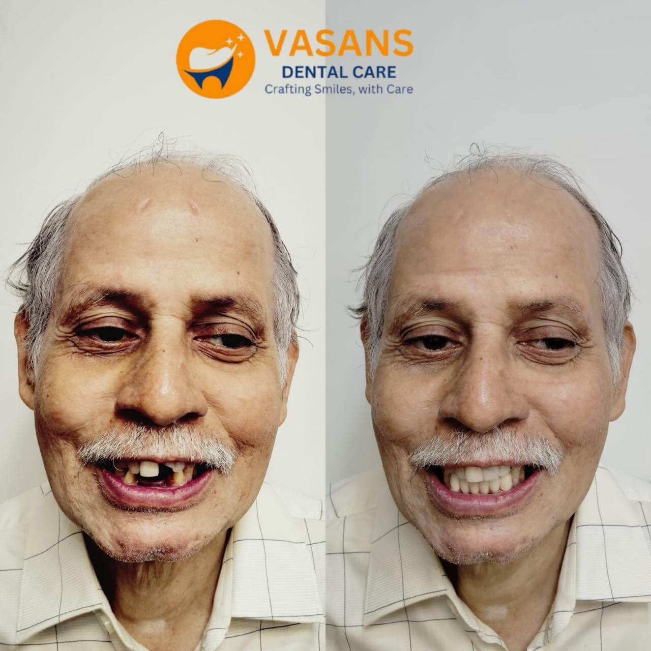 vasan-dental-care-gallery (6)