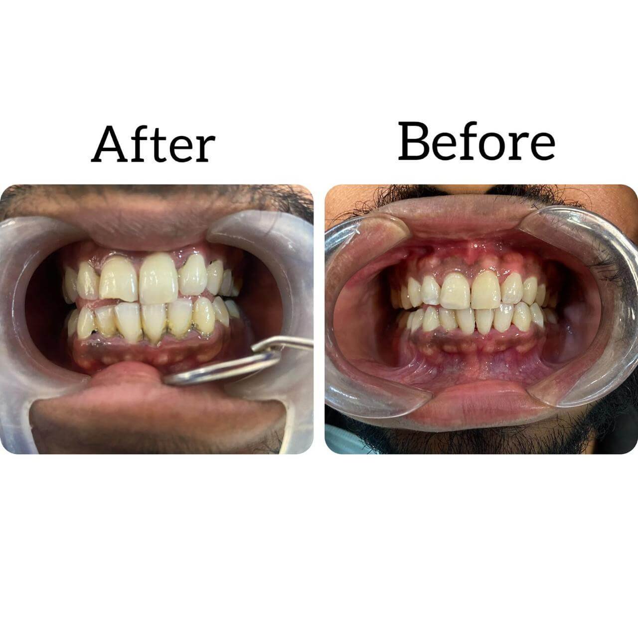 vasan-dental-care-gallery (7)