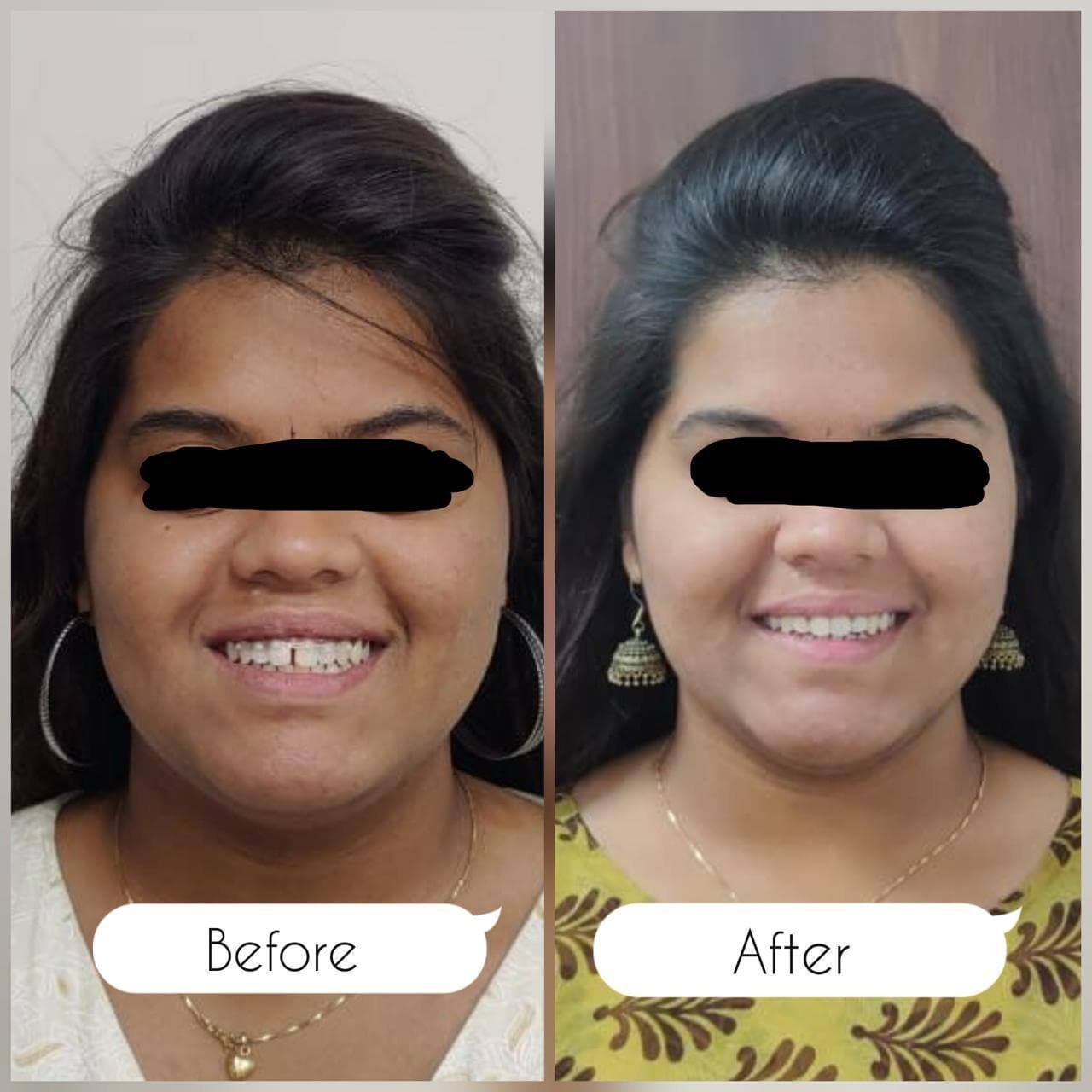 vasan-dental-care-gallery (8)