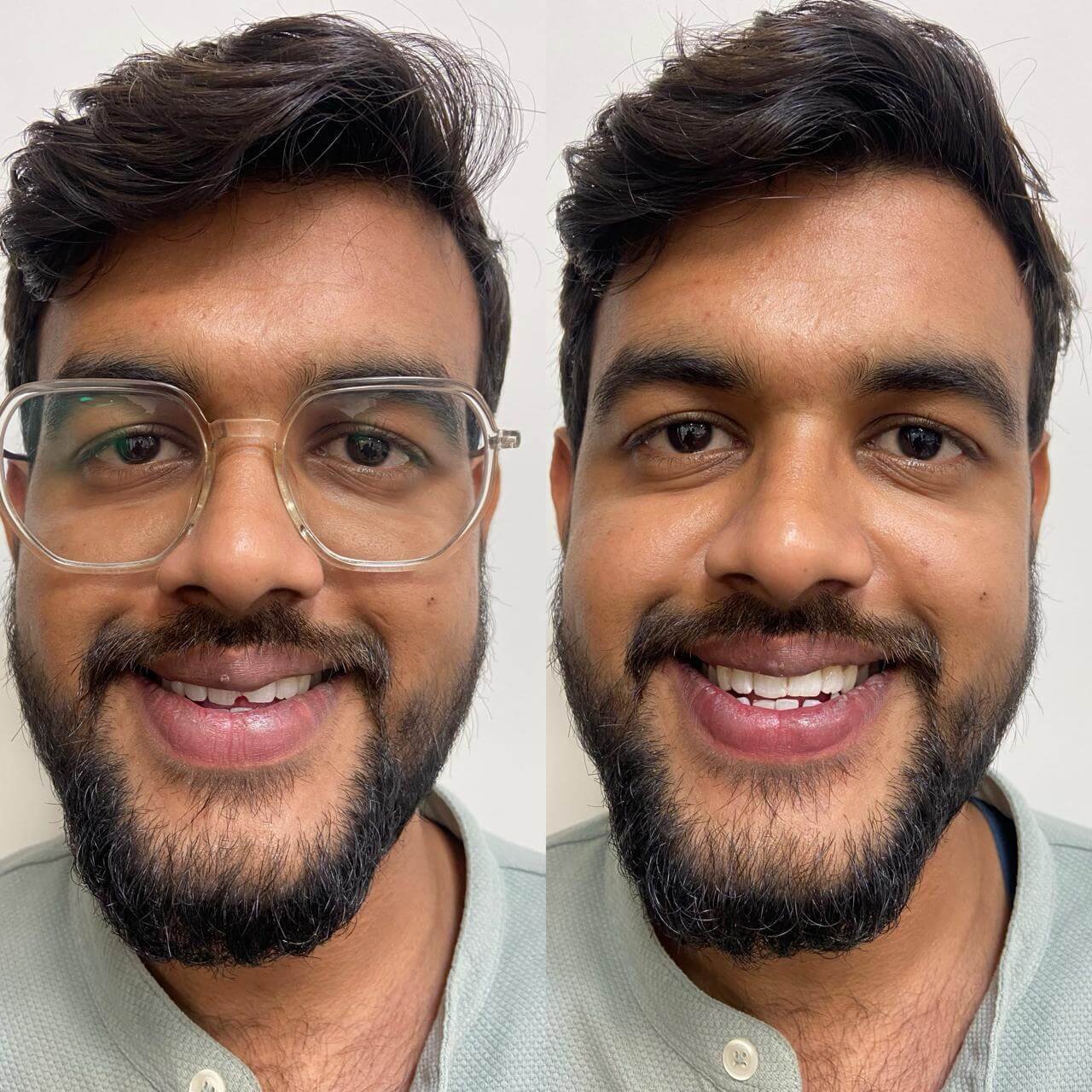 vasan-dental-care-gallery (9)