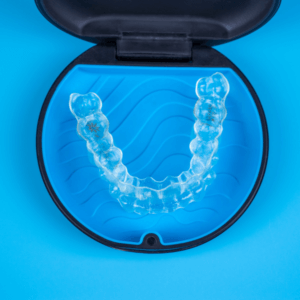 Aligners