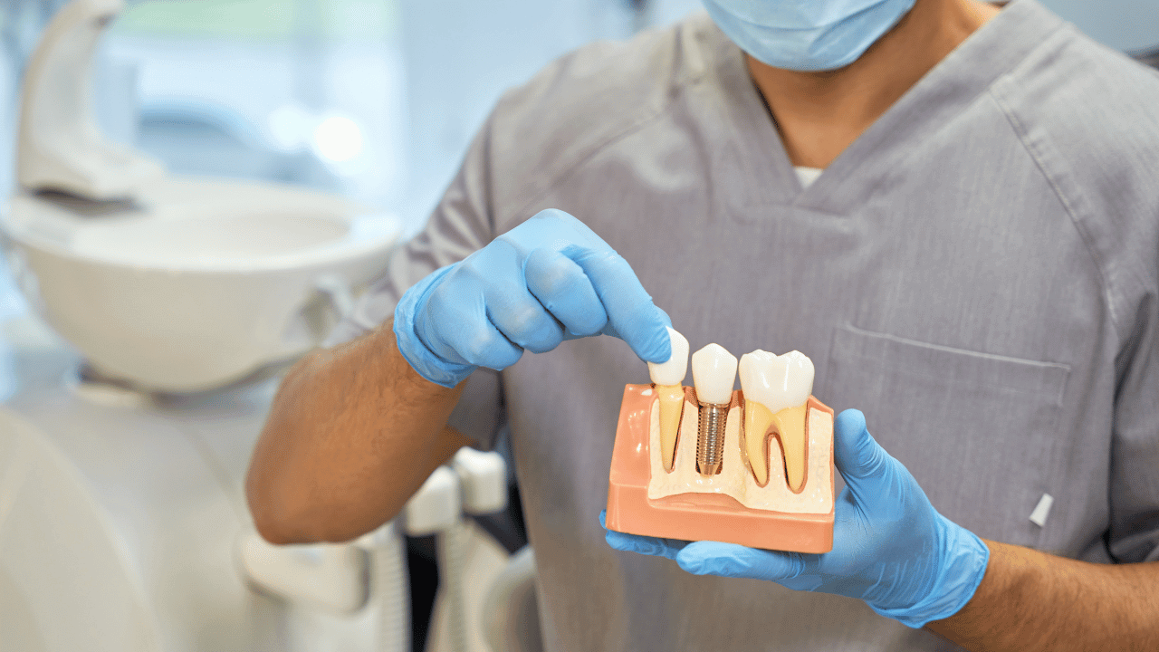 Dental Implants Treatment in Hyderabad