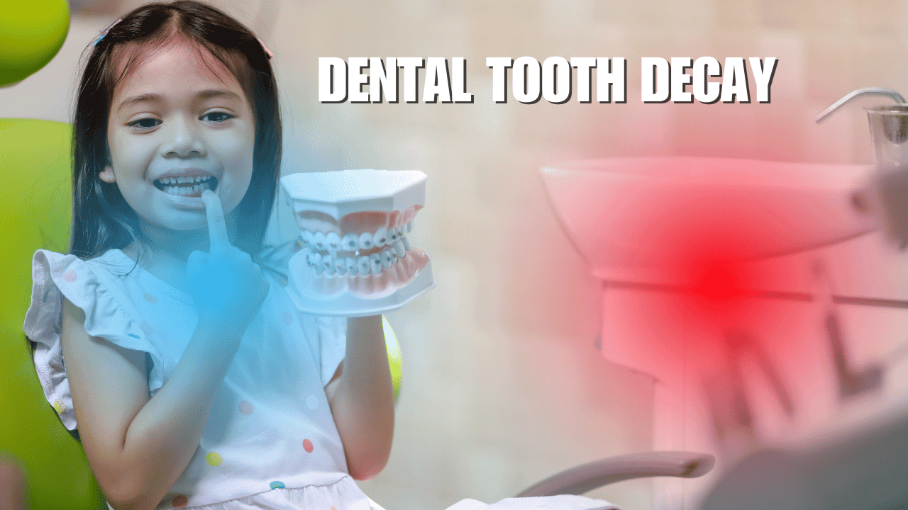 dental tooth decay