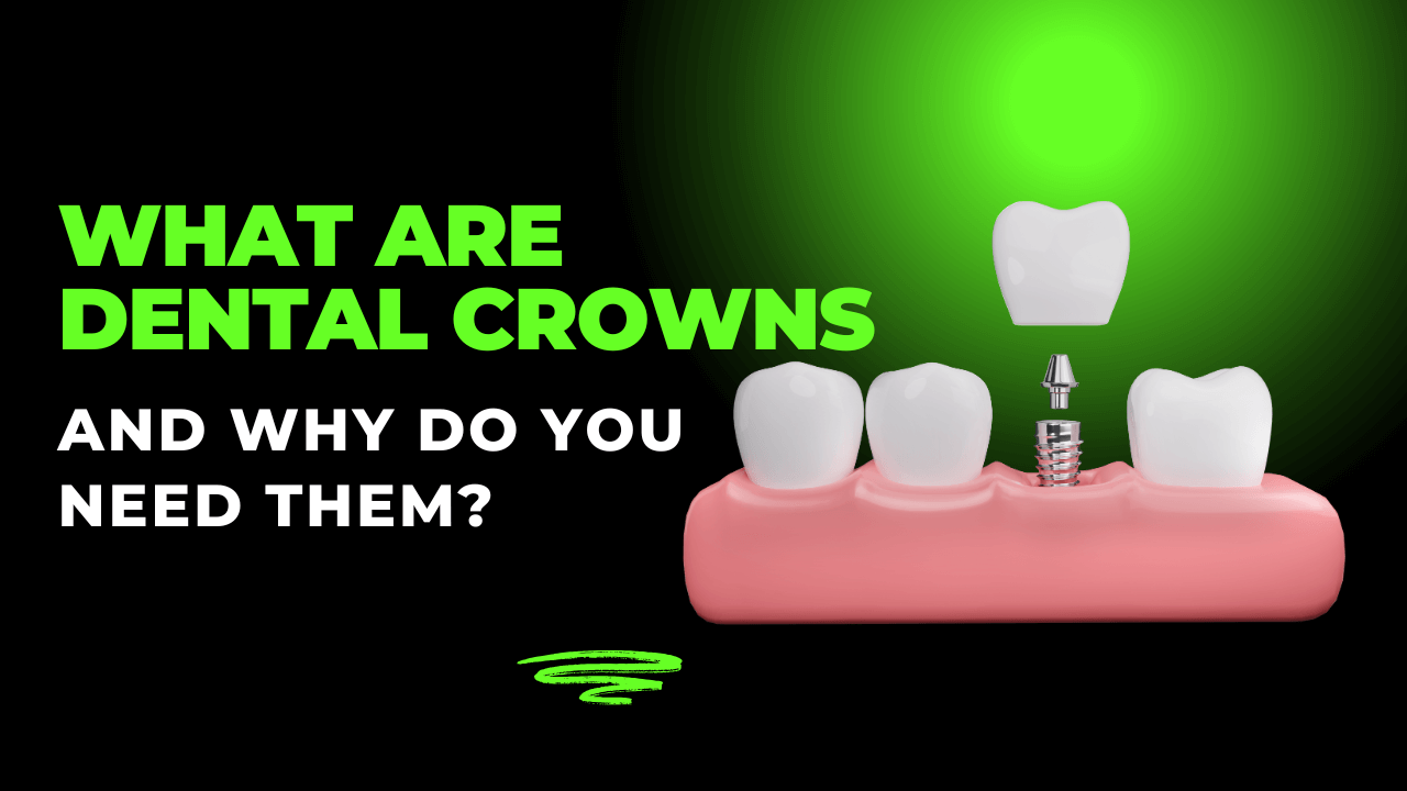 Dental Crowns